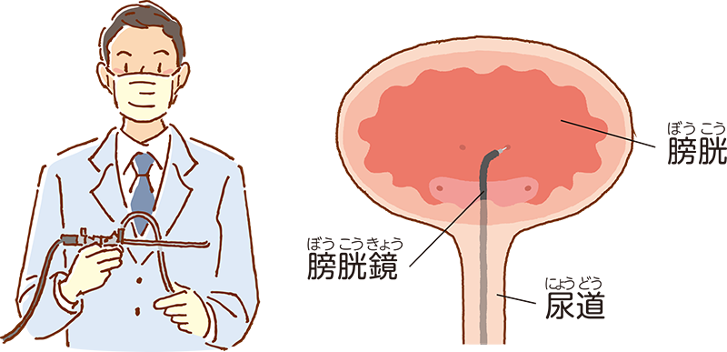 ボツリヌス療法の投与方法